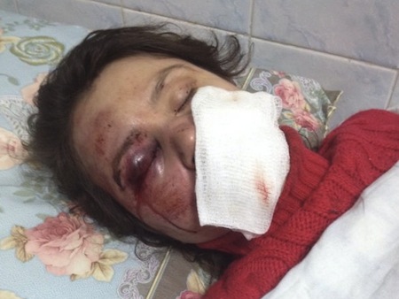 Побили журналістку Тетяну Чорновол (фото)