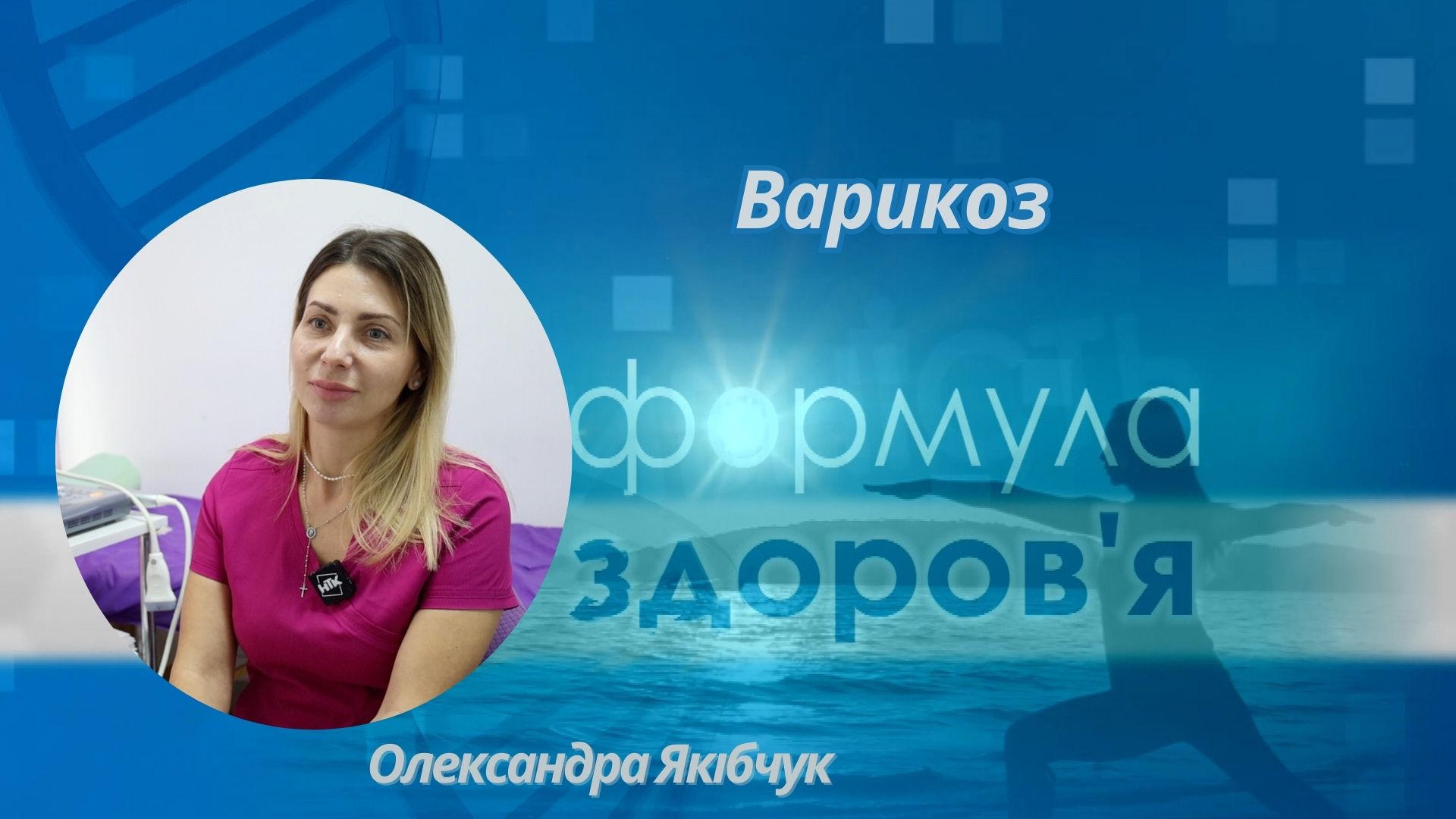 «Формула здоров'я». Варикоз | Олександра Якібчук