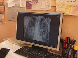 В Україні триває місяць обізнаності про туберкульоз (відео)