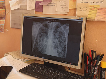 В Україні триває місяць обізнаності про туберкульоз (відео)